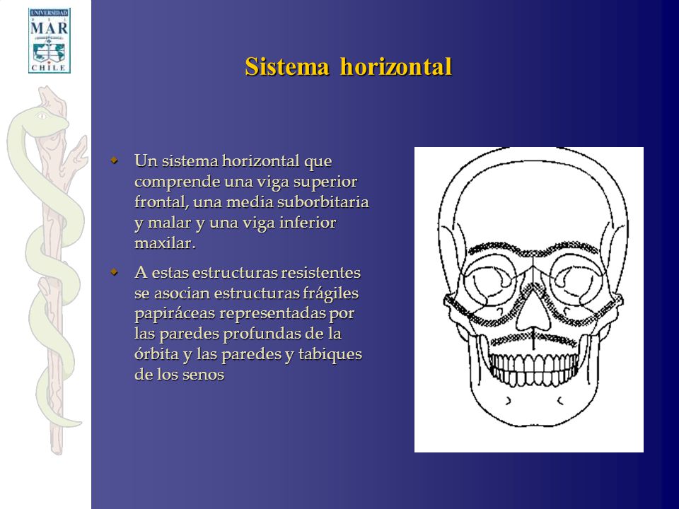 Sistema horizontal Un sistema horizontal que comprende una viga superior frontal, una media suborbitaria y malar y una viga inferior maxilar.