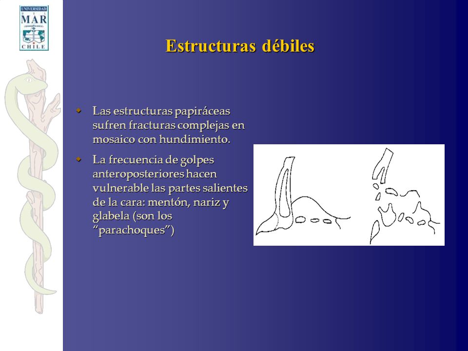 Estructuras débiles Las estructuras papiráceas sufren fracturas complejas en mosaico con hundimiento.