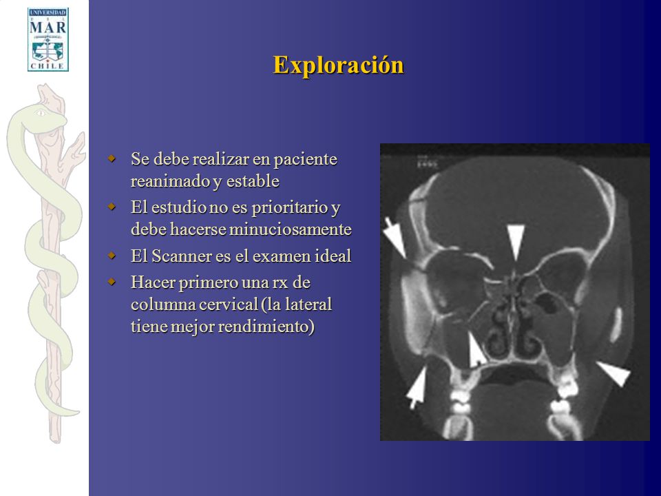 Exploración Se debe realizar en paciente reanimado y estable