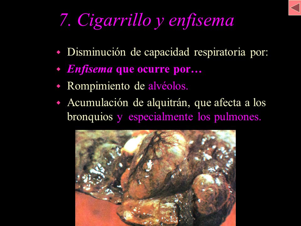 7. Cigarrillo y enfisema Disminución de capacidad respiratoria por: