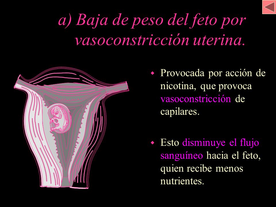 a) Baja de peso del feto por . vasoconstricción uterina.