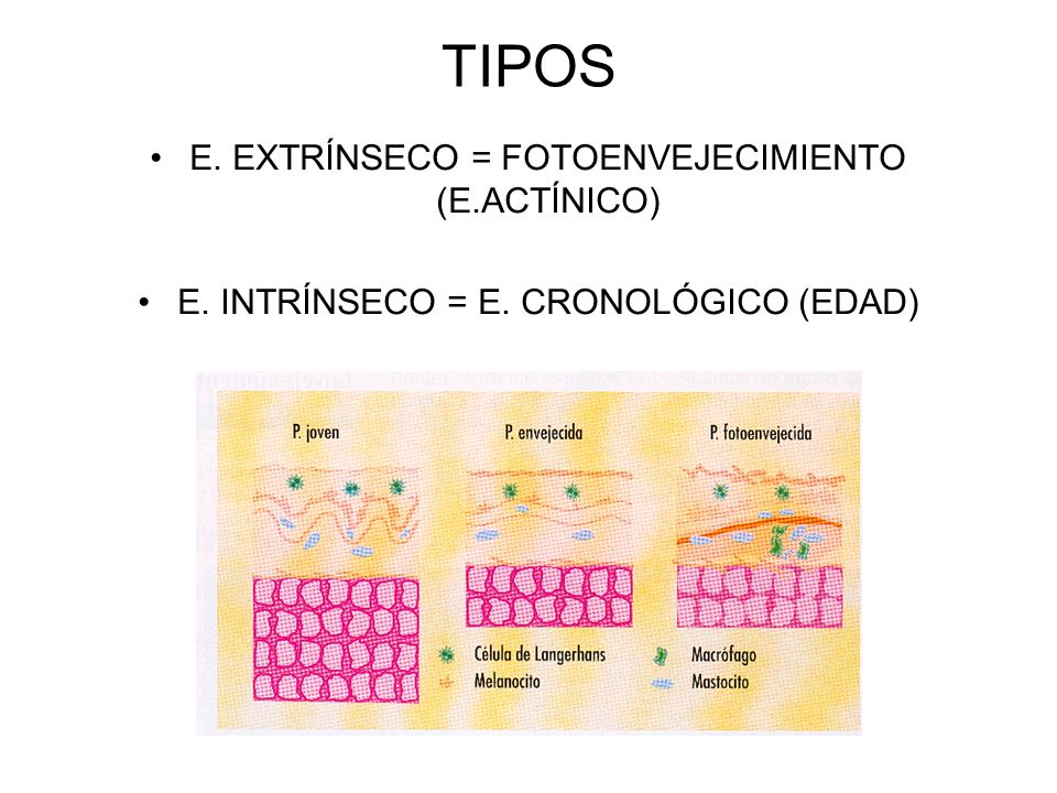 TIPOS E. EXTRÍNSECO = FOTOENVEJECIMIENTO (E.ACTÍNICO)