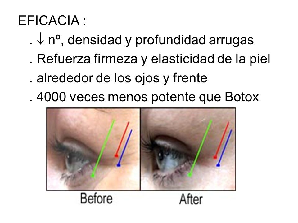EFICACIA : .  nº, densidad y profundidad arrugas. . Refuerza firmeza y elasticidad de la piel. . alrededor de los ojos y frente.