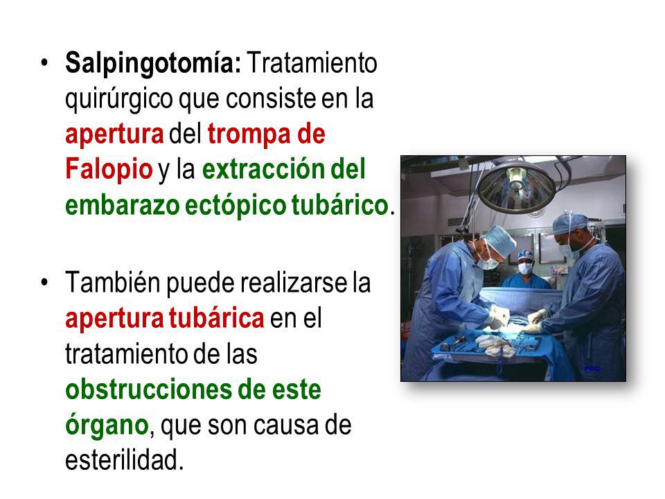 Salpingotomía: Tratamiento quirúrgico que consiste en la apertura del trompa de Falopio y la extracción del embarazo ectópico tubárico.
