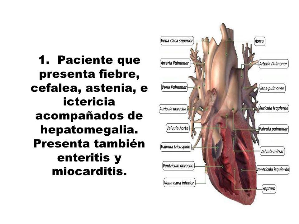 1. Paciente que presenta fiebre, cefalea, astenia, e ictericia acompañados de hepatomegalia.