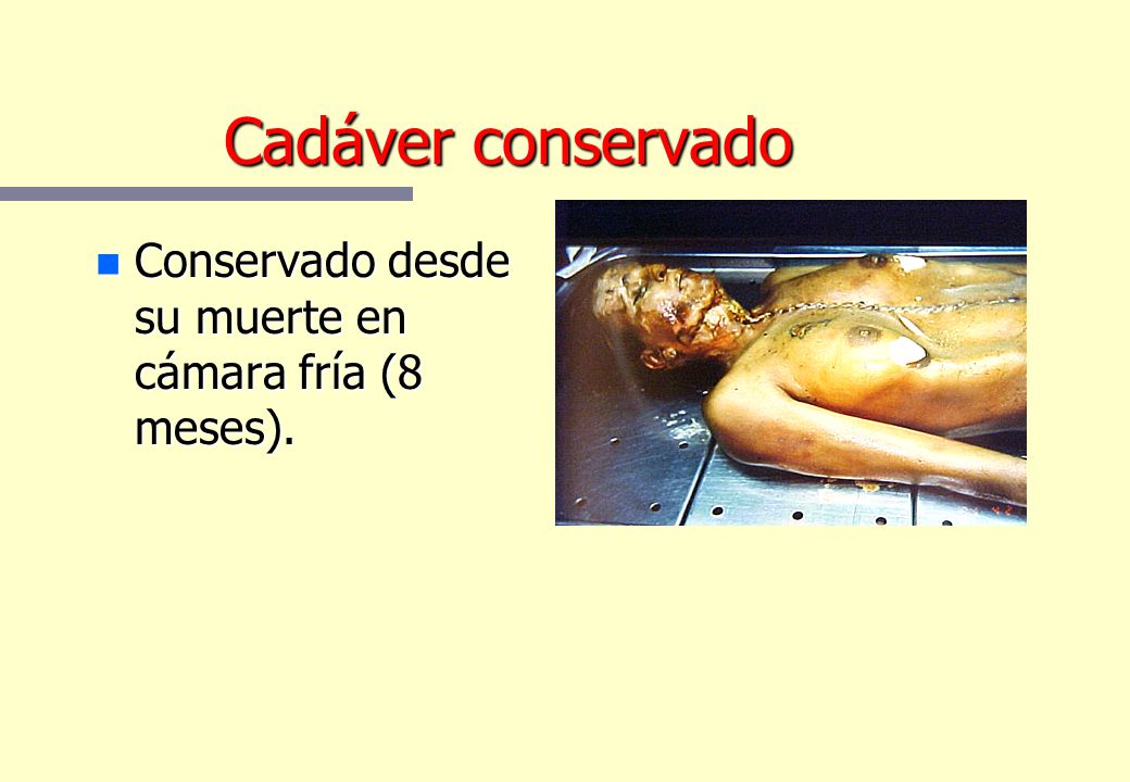 Cadáver conservado Conservado desde su muerte en cámara fría (8 meses).