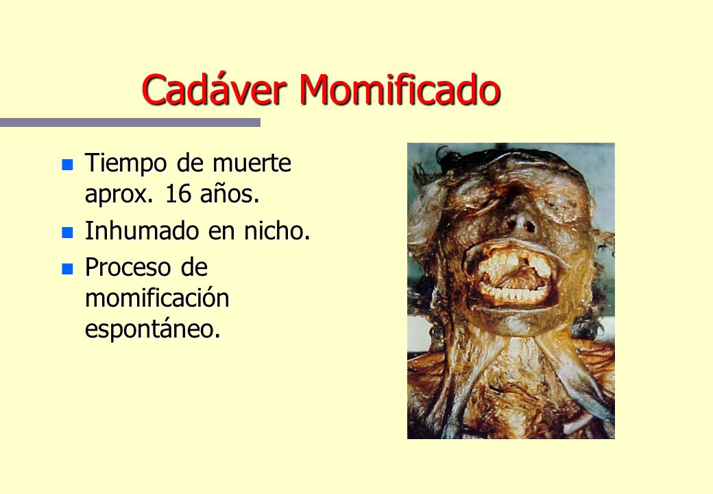 Cadáver Momificado Tiempo de muerte aprox. 16 años. Inhumado en nicho.