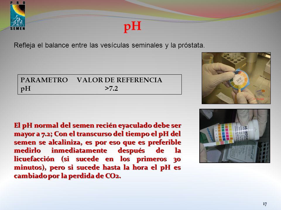 pH Refleja el balance entre las vesículas seminales y la próstata.