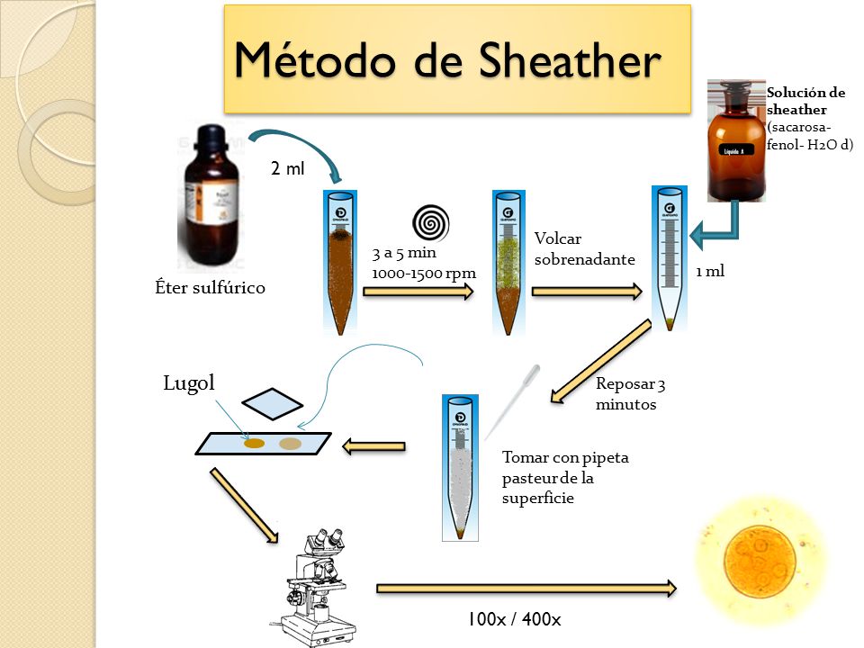 Método de Sheather Lugol 2 ml Éter sulfúrico 100x / 400x