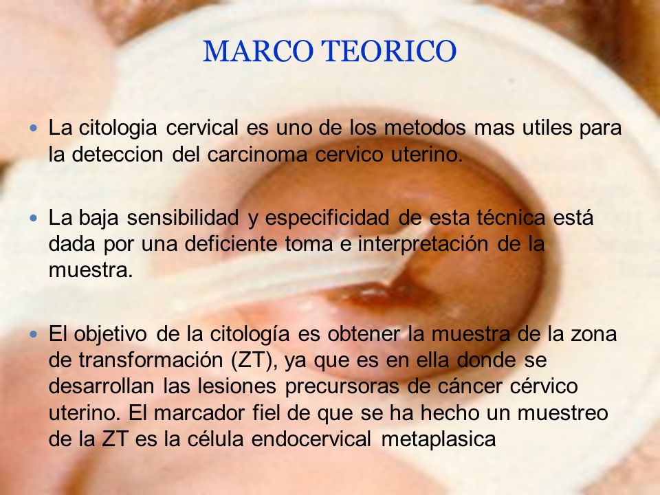 MARCO TEORICO La citologia cervical es uno de los metodos mas utiles para la deteccion del carcinoma cervico uterino.