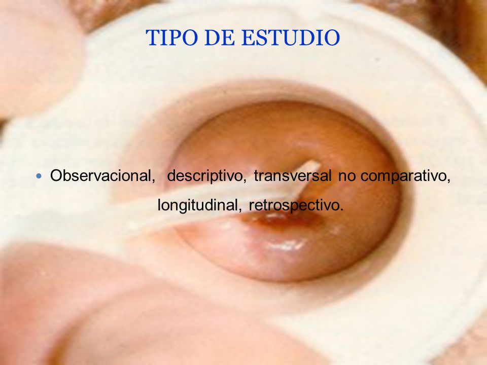 TIPO DE ESTUDIO Observacional, descriptivo, transversal no comparativo, longitudinal, retrospectivo.