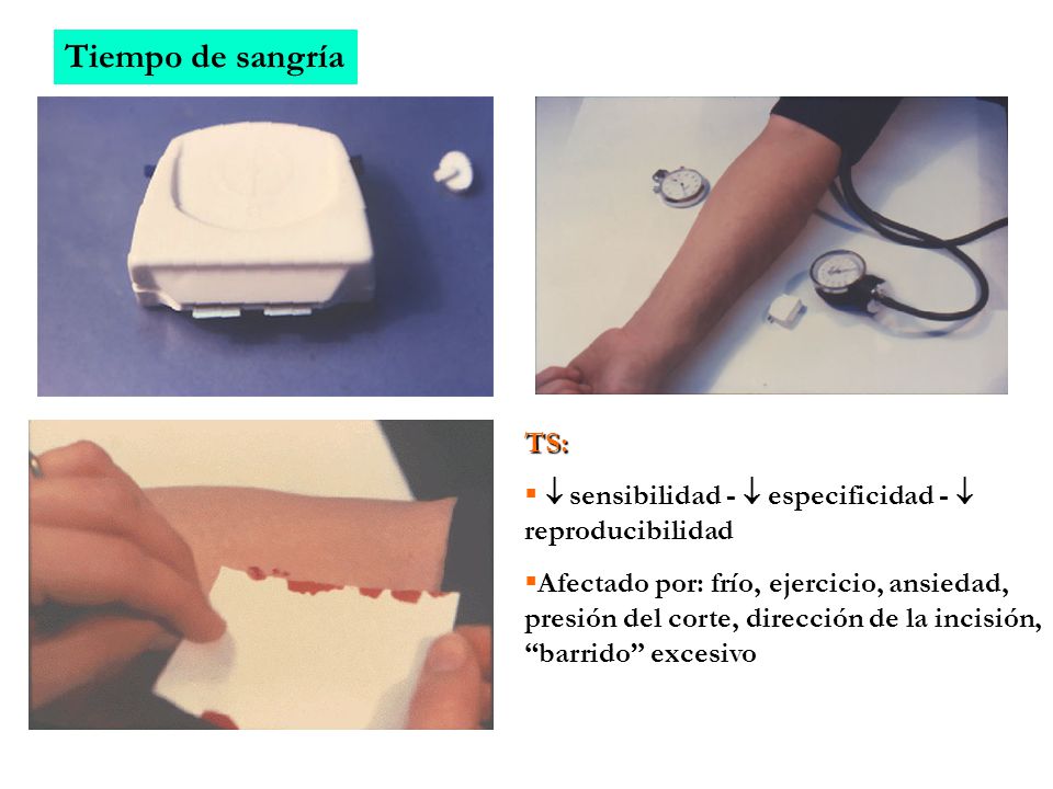 Tiempo de sangría TS:  sensibilidad -  especificidad -  reproducibilidad.