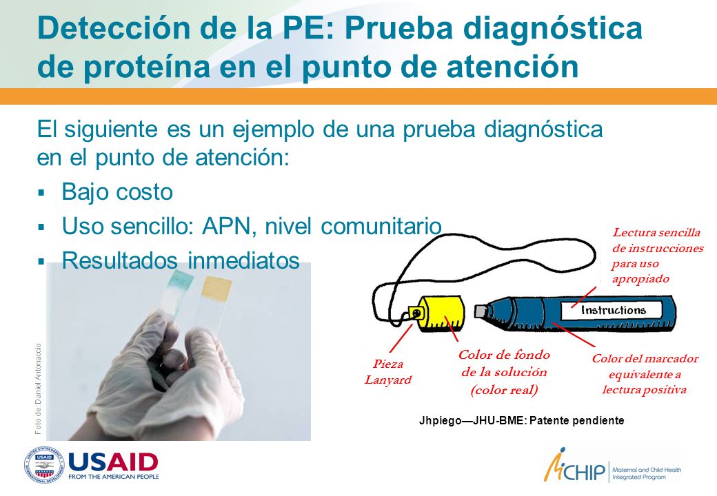Detección de la PE: Prueba diagnóstica de proteína en el punto de atención