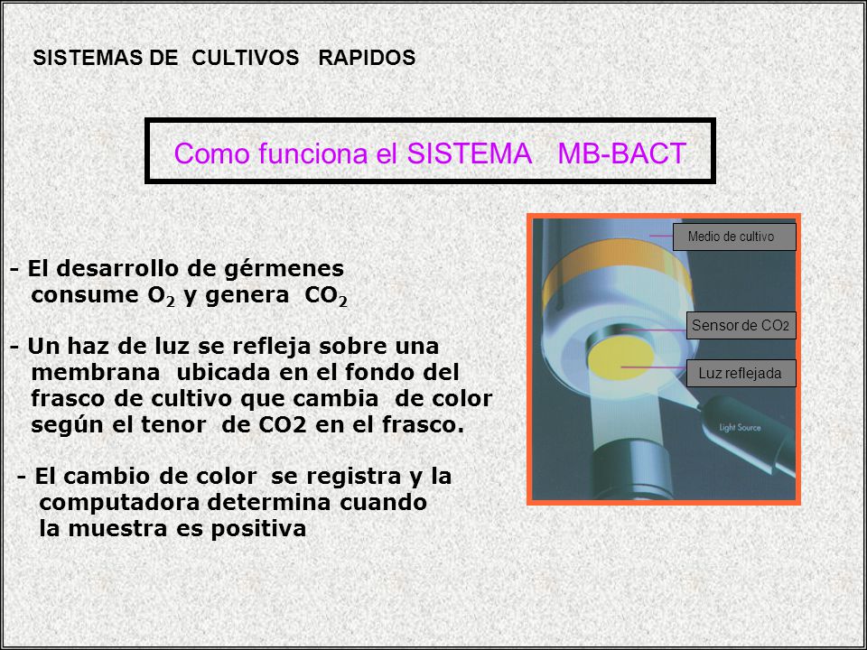 Como funciona el SISTEMA MB-BACT