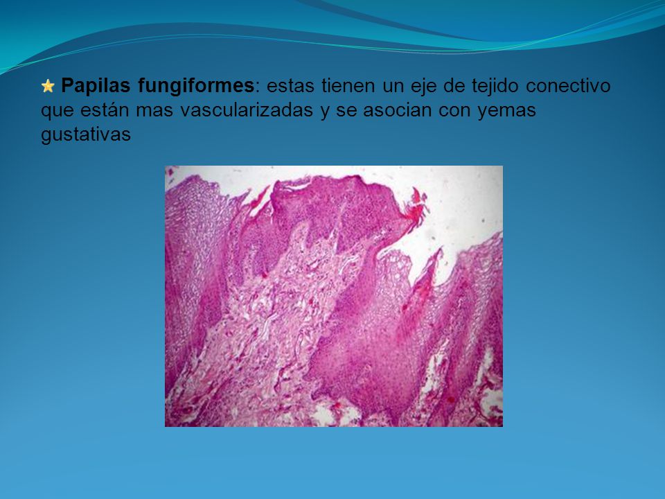Papilas fungiformes: estas tienen un eje de tejido conectivo que están mas vascularizadas y se asocian con yemas gustativas