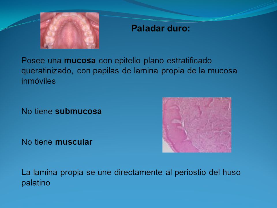 Paladar duro: Posee una mucosa con epitelio plano estratificado queratinizado, con papilas de lamina propia de la mucosa inmóviles.