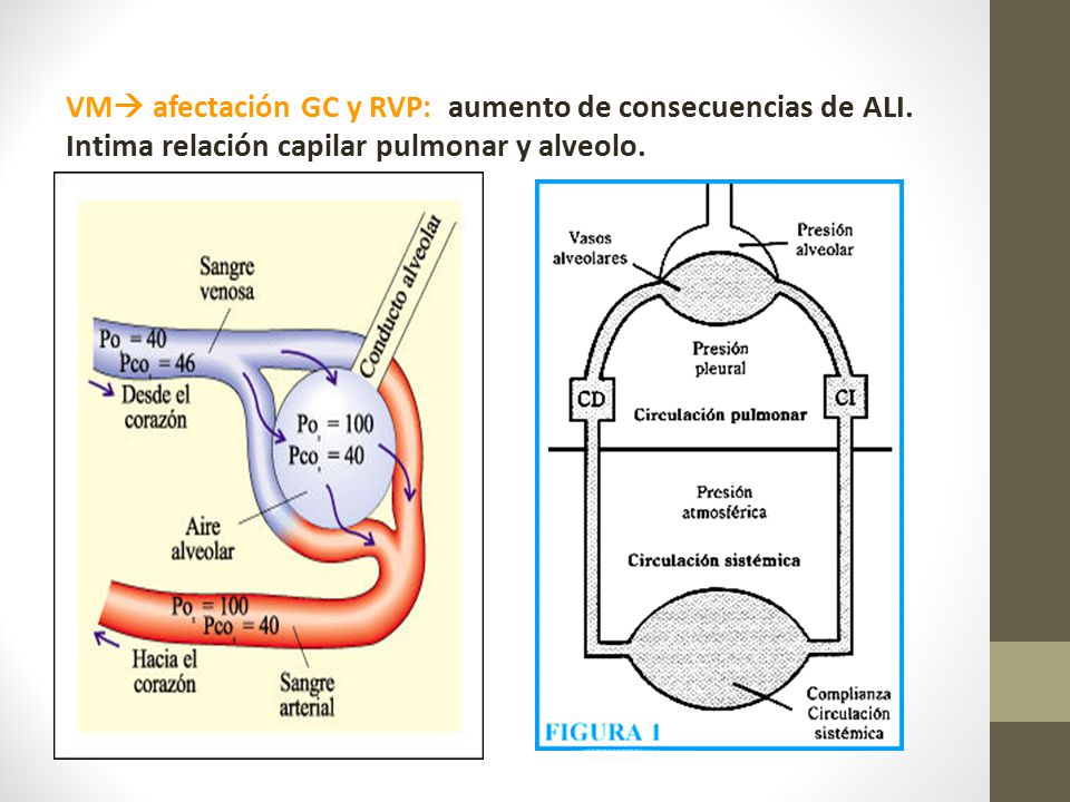 VM afectación GC y RVP: aumento de consecuencias de ALI.