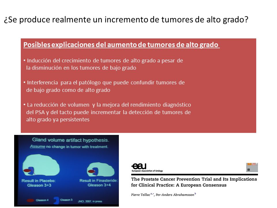¿Se produce realmente un incremento de tumores de alto grado