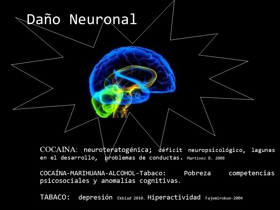 Daño Neuronal COCAINA: neuroteratogénica; déficit neuropsicológico, lagunas en el desarrollo, problemas de conductas. Martinez B