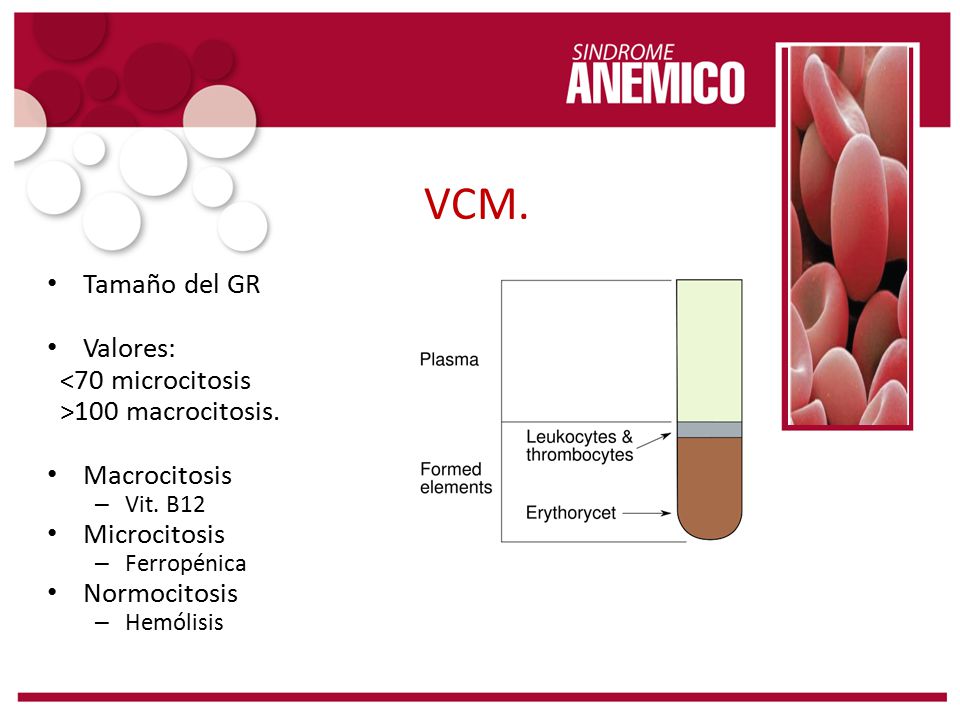 VCM. Tamaño del GR Valores: <70 microcitosis >100 macrocitosis.