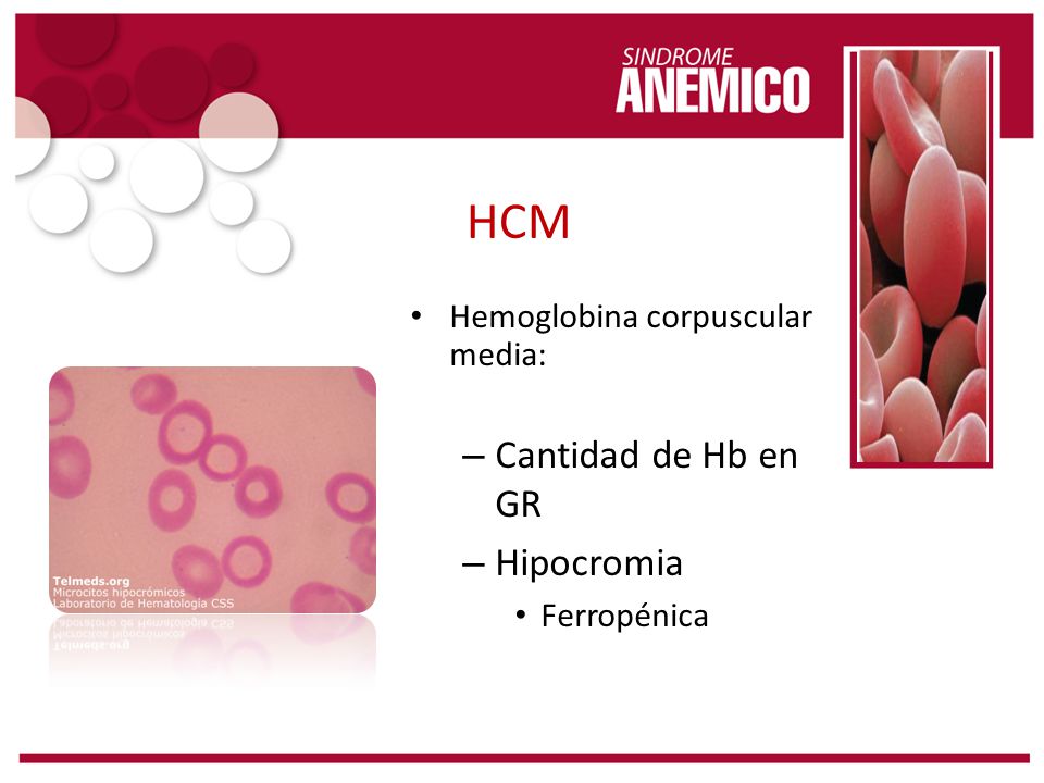 HCM Cantidad de Hb en GR Hipocromia Hemoglobina corpuscular media: