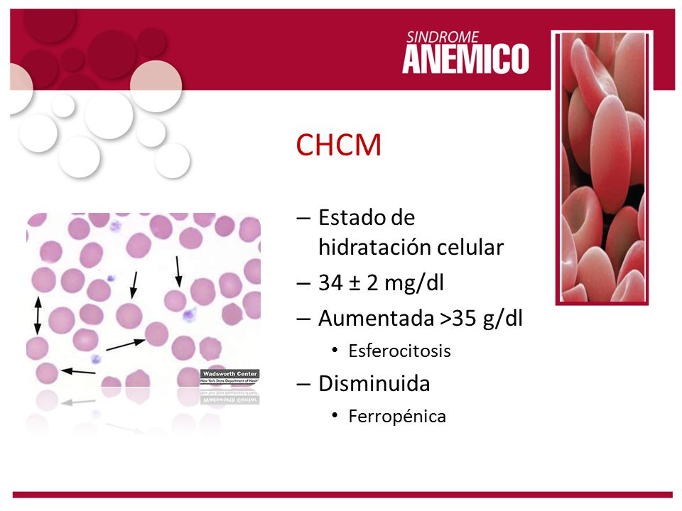 CHCM Estado de hidratación celular 34 ± 2 mg/dl Aumentada >35 g/dl