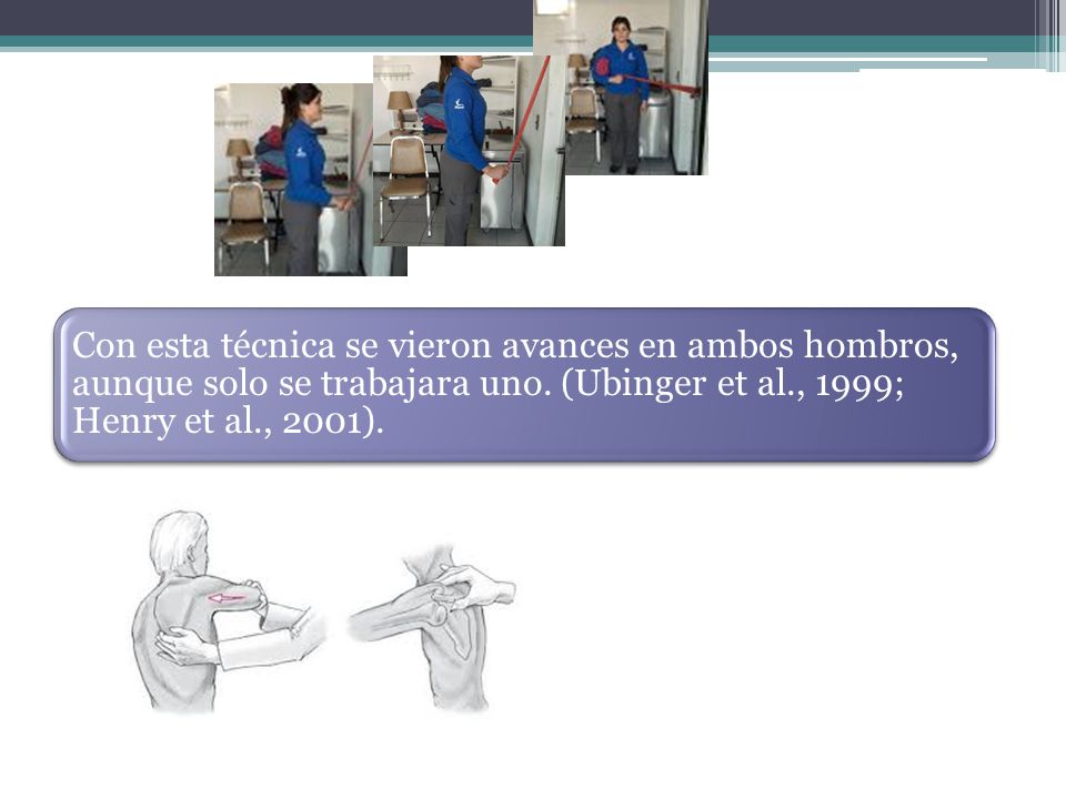 Con esta técnica se vieron avances en ambos hombros, aunque solo se trabajara uno.