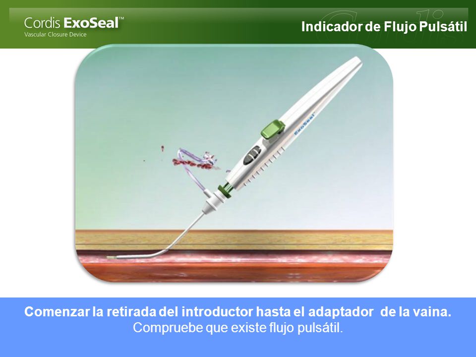 Comenzar la retirada del introductor hasta el adaptador de la vaina.
