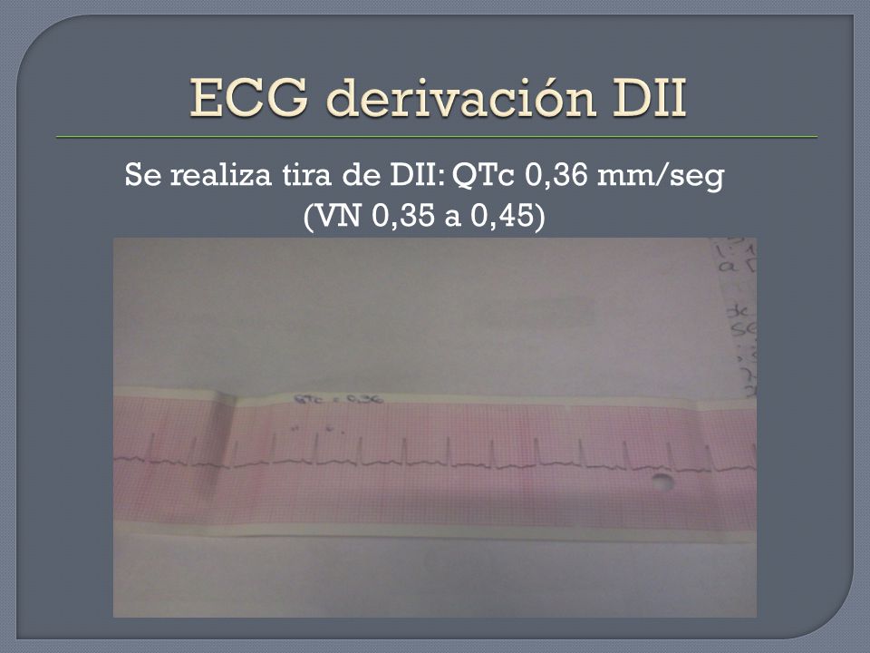 Se realiza tira de DII: QTc 0,36 mm/seg (VN 0,35 a 0,45)
