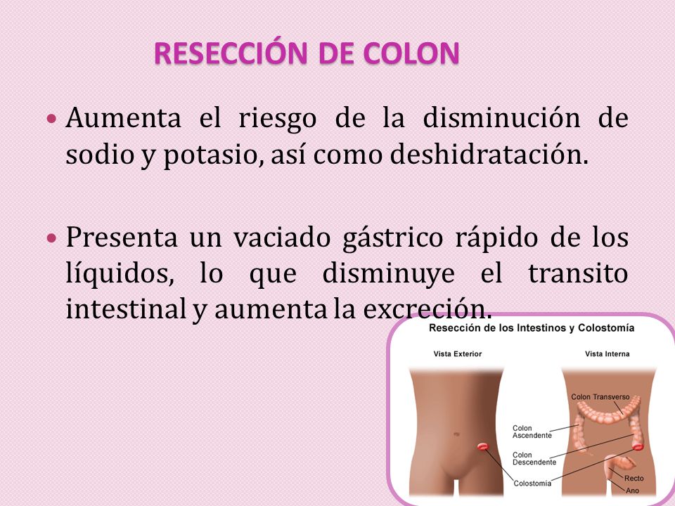 Resección de colon Aumenta el riesgo de la disminución de sodio y potasio, así como deshidratación.