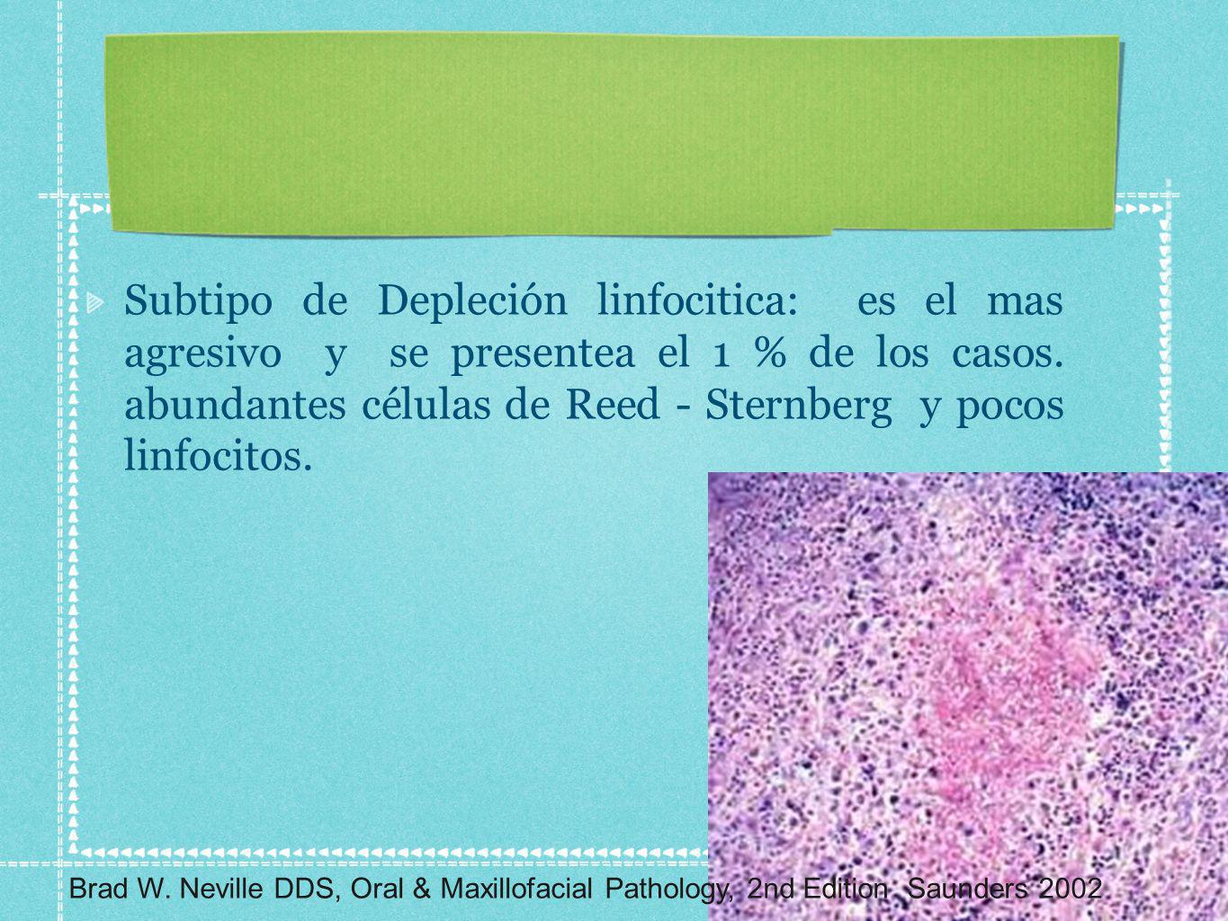 Subtipo de Depleción linfocitica: es el mas agresivo y se presentea el 1 % de los casos. abundantes células de Reed - Sternberg y pocos linfocitos.