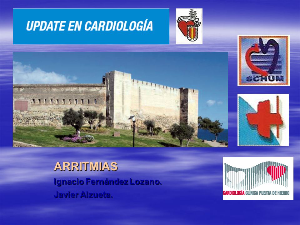 ARRITMIAS Ignacio Fernández Lozano. Javier Alzueta.