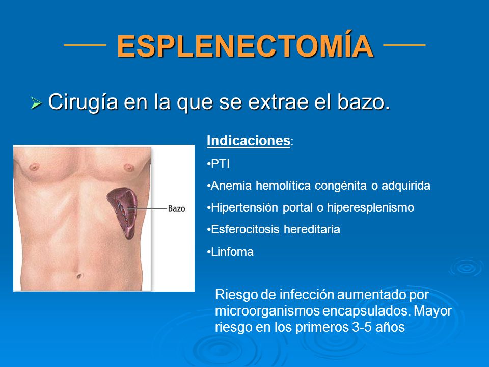ESPLENECTOMÍA Cirugía en la que se extrae el bazo. Indicaciones: