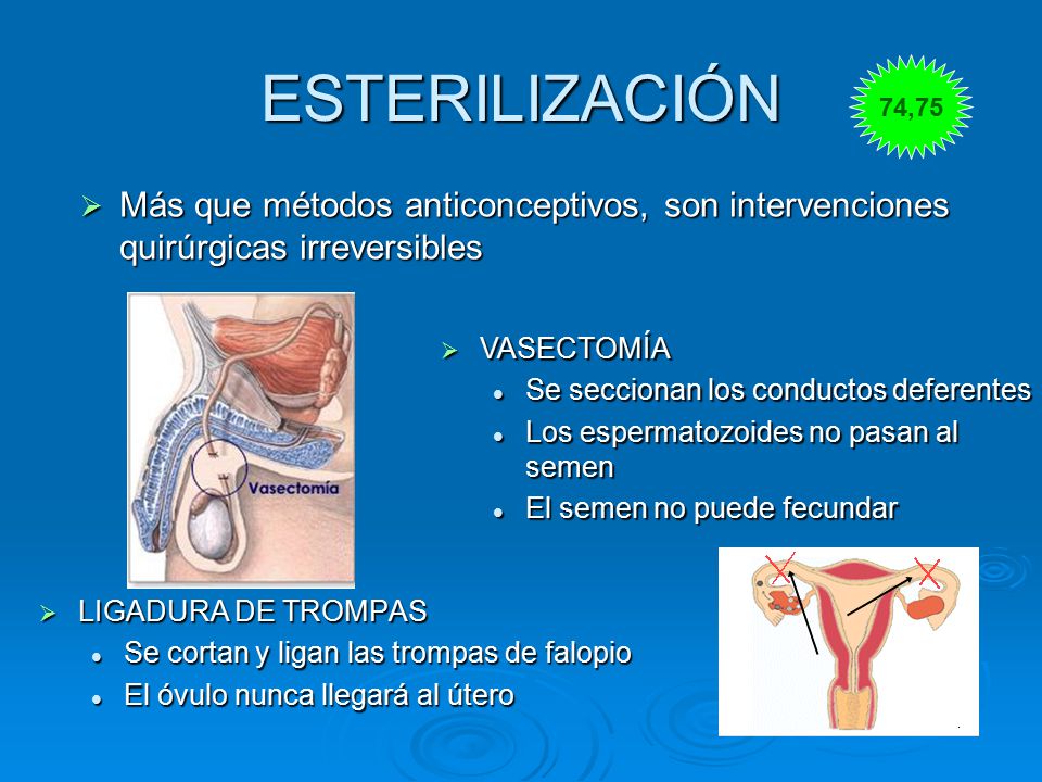 ESTERILIZACIÓN 74,75. Más que métodos anticonceptivos, son intervenciones quirúrgicas irreversibles.