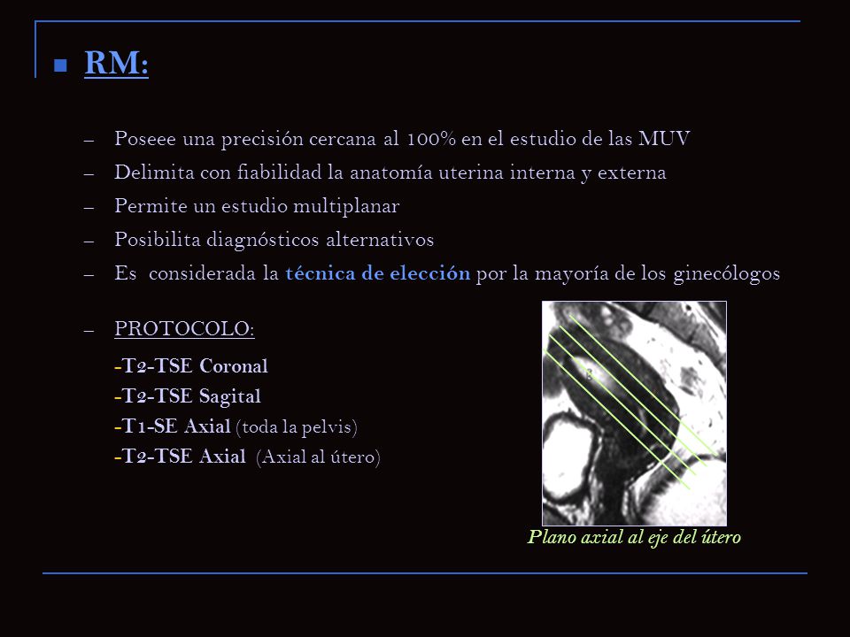 RM: Poseee una precisión cercana al 100% en el estudio de las MUV