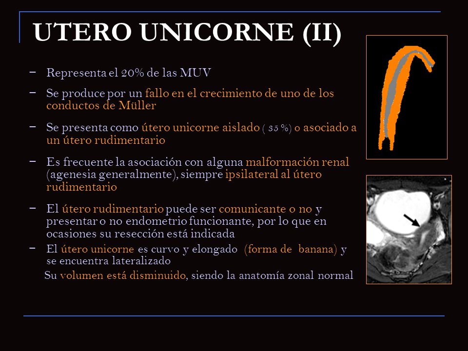 UTERO UNICORNE (II) Representa el 20% de las MUV