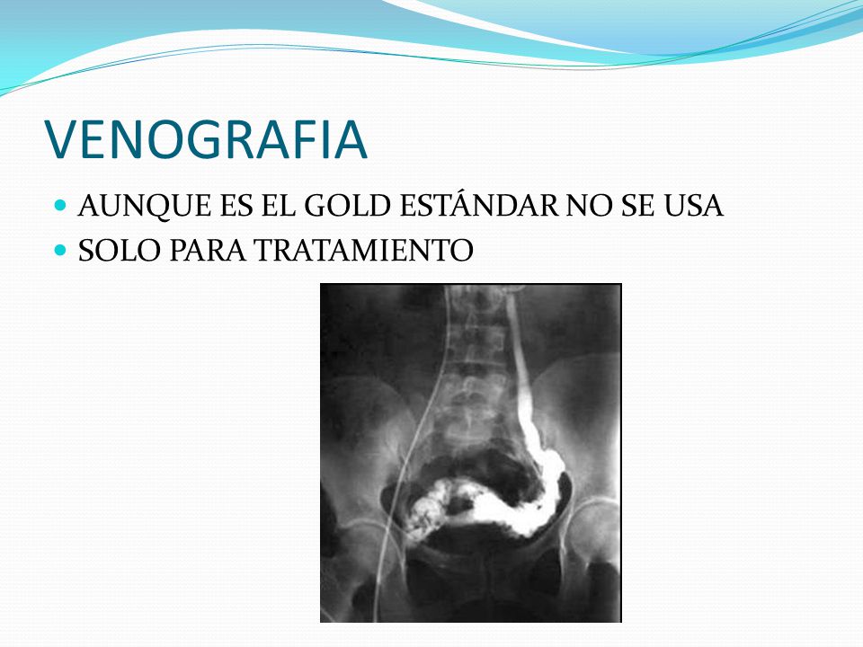 VENOGRAFIA AUNQUE ES EL GOLD ESTÁNDAR NO SE USA SOLO PARA TRATAMIENTO