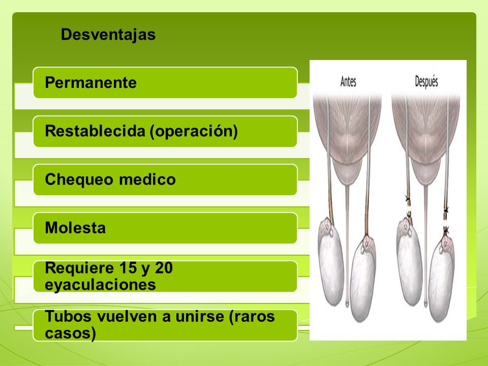 Desventajas Permanente. Restablecida (operación) Chequeo medico. Molesta. Requiere 15 y 20 eyaculaciones.