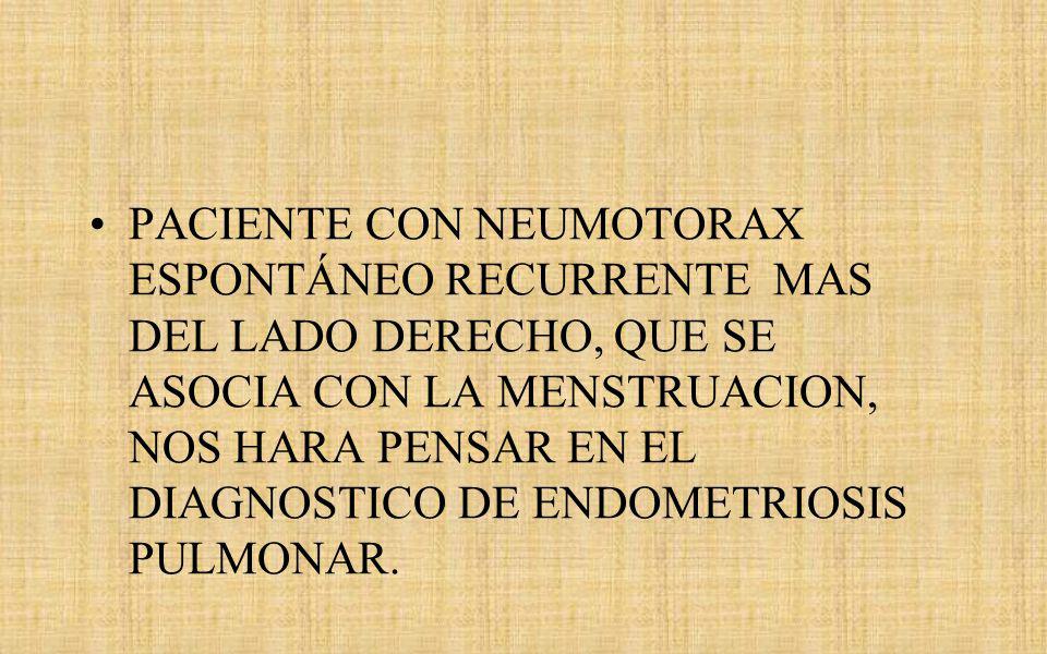 PACIENTE CON NEUMOTORAX ESPONTÁNEO RECURRENTE MAS DEL LADO DERECHO, QUE SE ASOCIA CON LA MENSTRUACION, NOS HARA PENSAR EN EL DIAGNOSTICO DE ENDOMETRIOSIS PULMONAR.