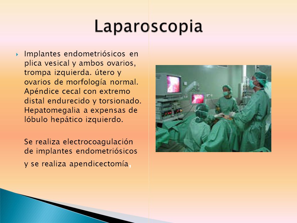 Implantes endometriósicos en plica vesical y ambos ovarios, trompa izquierda. útero y ovarios de morfología normal. Apéndice cecal con extremo distal endurecido y torsionado. Hepatomegalia a expensas de lóbulo hepático izquierdo.
