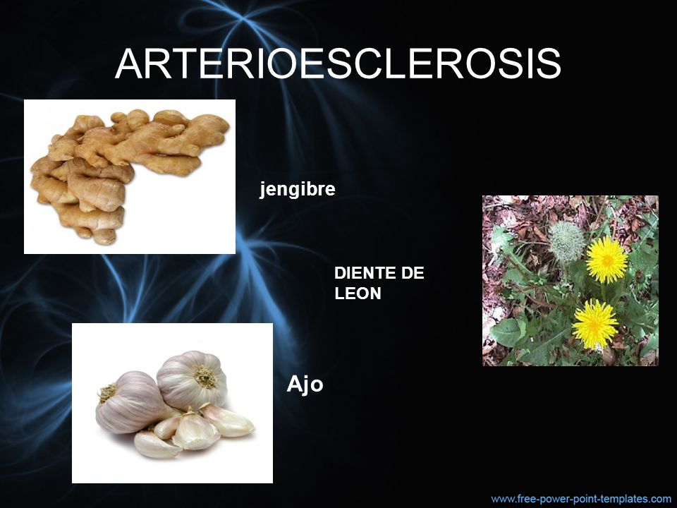 ARTERIOESCLEROSIS jengibre DIENTE DE LEON Ajo