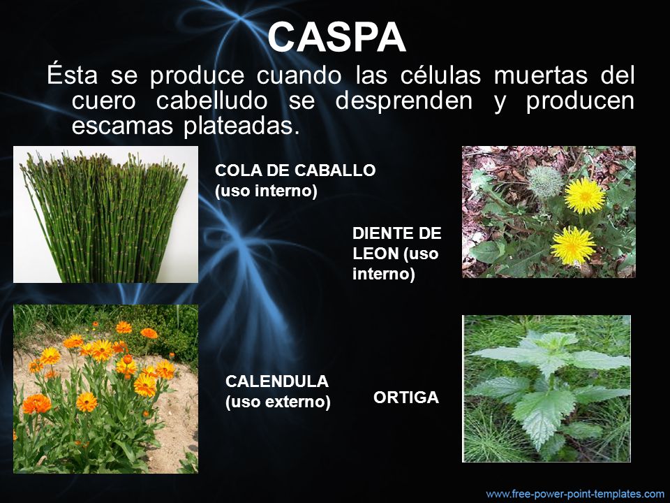 CASPA Ésta se produce cuando las células muertas del cuero cabelludo se desprenden y producen escamas plateadas.