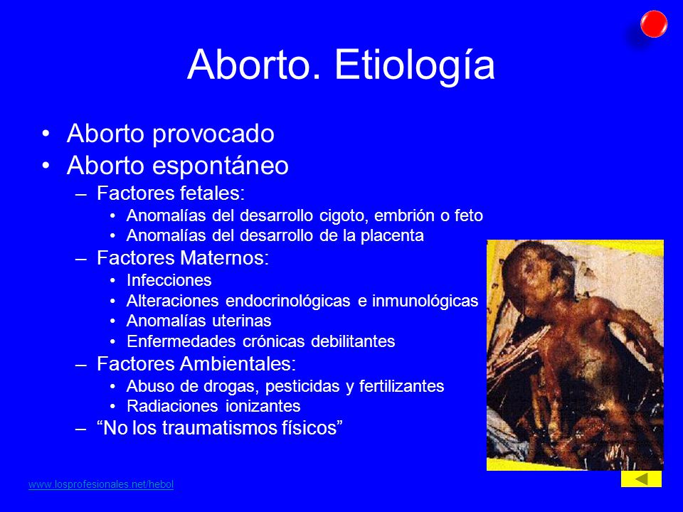 Aborto. Etiología Aborto provocado Aborto espontáneo Factores fetales: