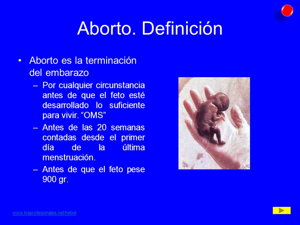 Aborto. Definición Aborto es la terminación del embarazo