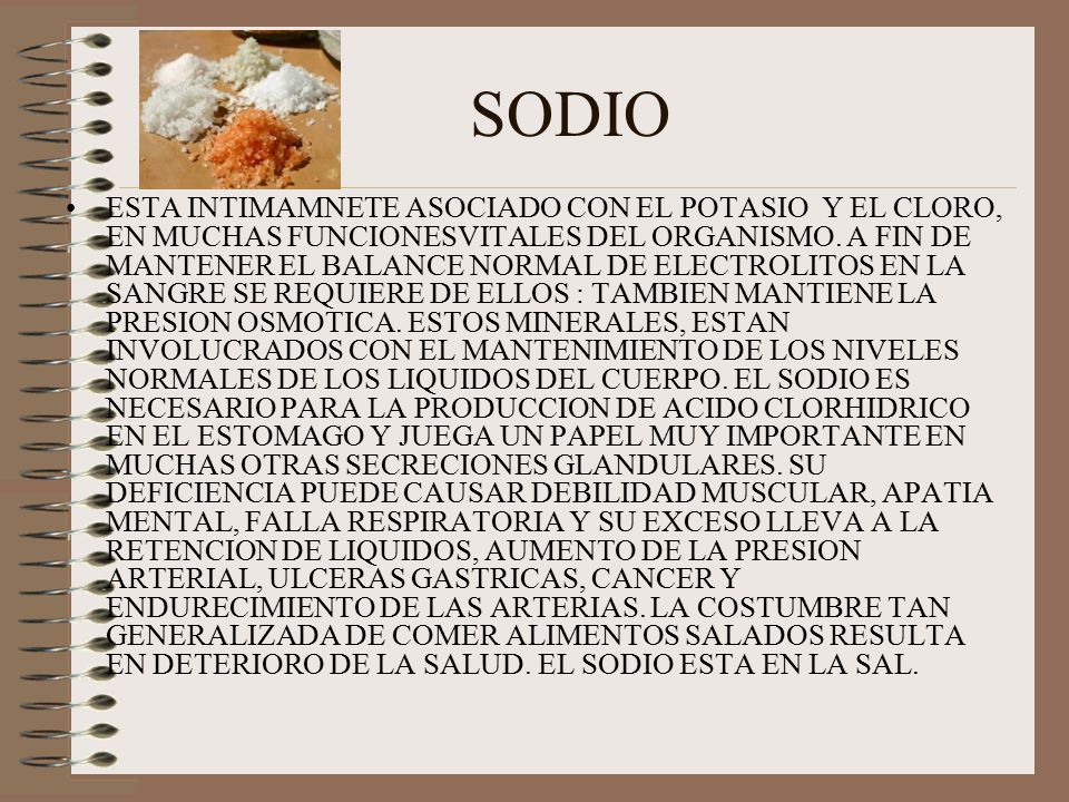 SODIO