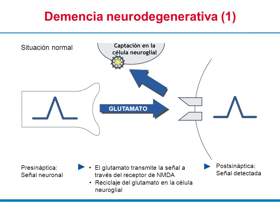 Demencia neurodegenerativa (1)