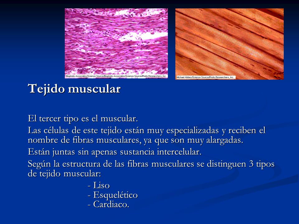 Tejido muscular El tercer tipo es el muscular.