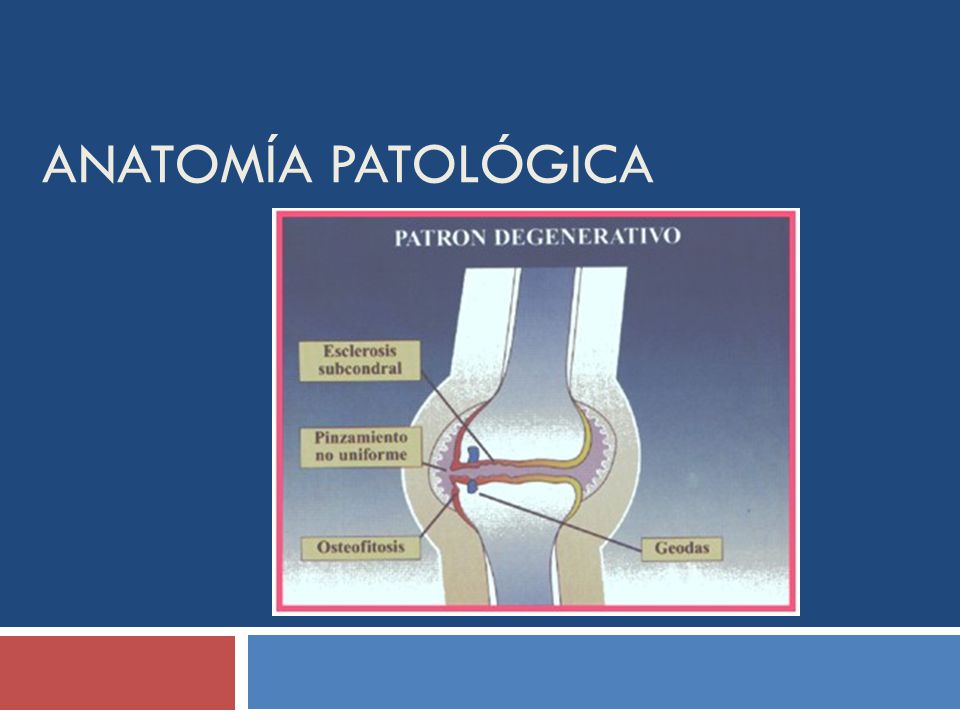 Anatomía patológica
