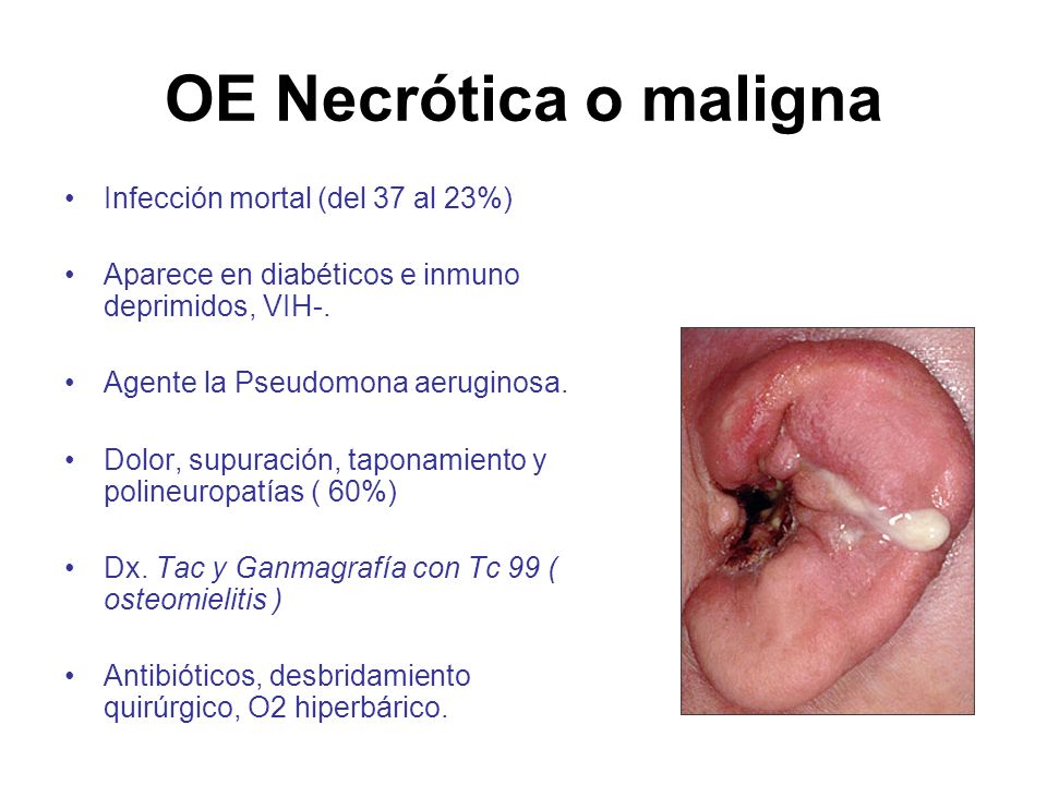 OE Necrótica o maligna Infección mortal (del 37 al 23%)