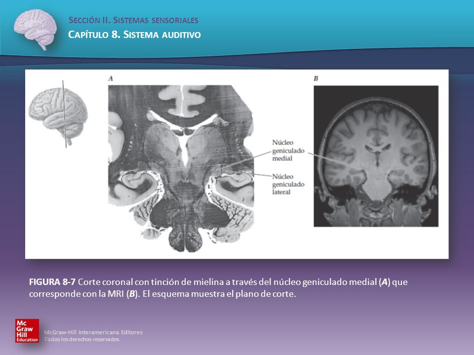 FIGURA 8-7 Corte coronal con tinción de mielina a través del núcleo geniculado medial (A) que corresponde con la MRI (B).